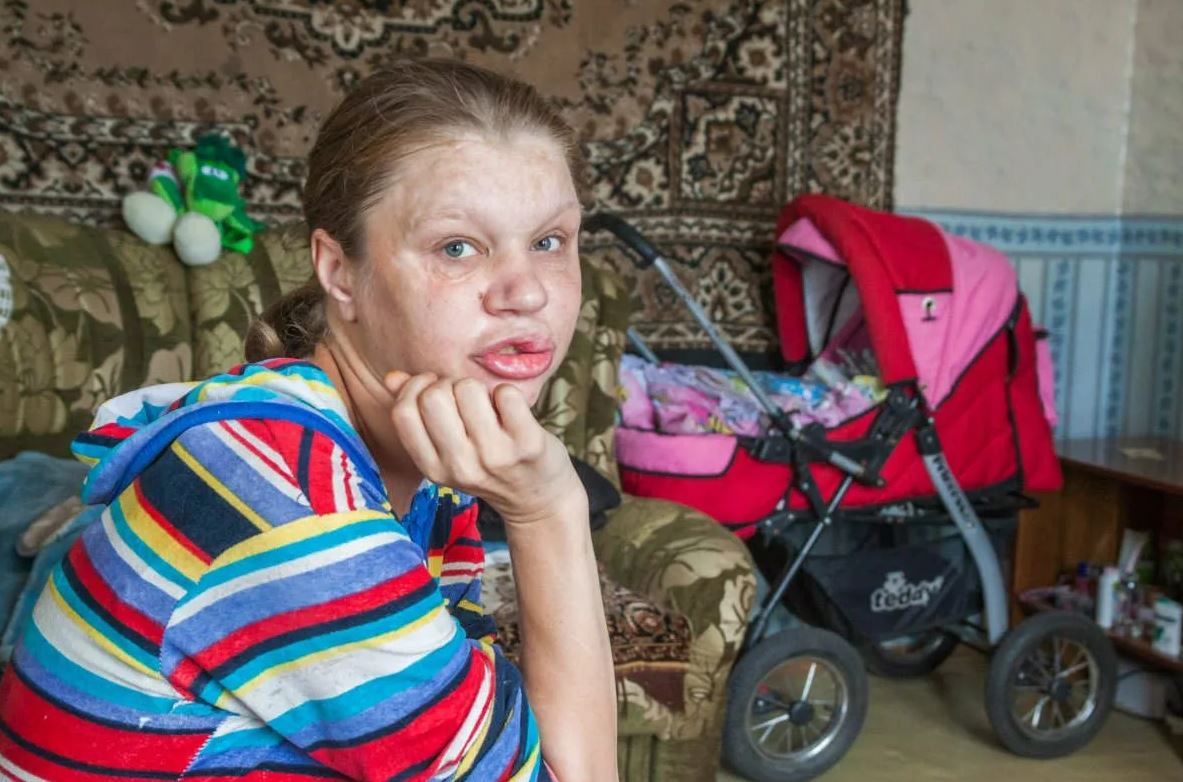 Страдают дети